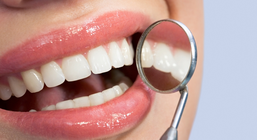 hygiene-cleaning-teeth-whitening-brush-n-floss-dental-victoria-1