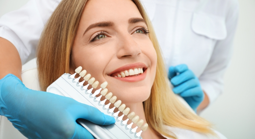 porcelain-veneers-brush-n-floss-dental-victoria