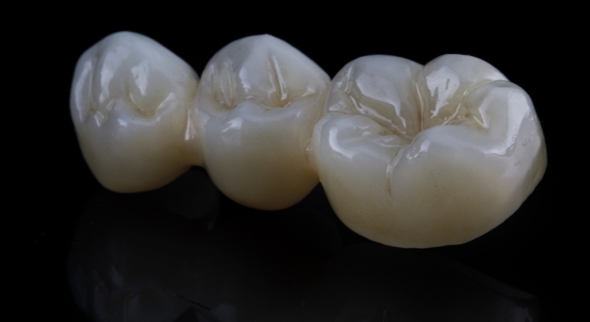 tooth-crown-brush-n-floss-dental-victoria-australia